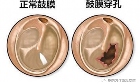 萬江眼科醫生說，聽力下降耳屎不背這個鍋