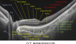 我院引入國(guó)產(chǎn)OCTA眼科特檢技術(shù)