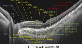 我院引入國(guó)產(chǎn)OCTA眼科特檢技術(shù)