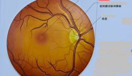 健康科普｜小測試，來看看您的黃斑還好嗎？