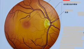 健康科普｜小测试，来看看您的黄斑还好吗？