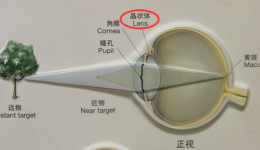 健康科普｜人未到中年，最不喜歡什么“花”？