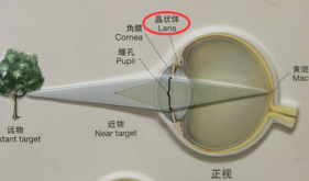 健康科普｜人未到中年，最不喜歡什么“花”？