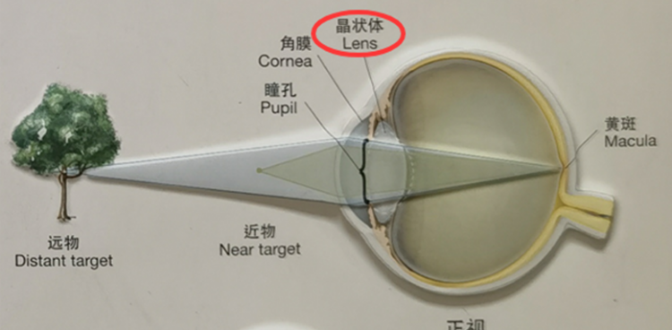 健康科普｜人未到中年，最不喜歡什么“花”？