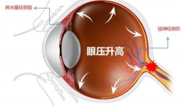 健康科普｜“三高”之外的這一“高”可否知曉？