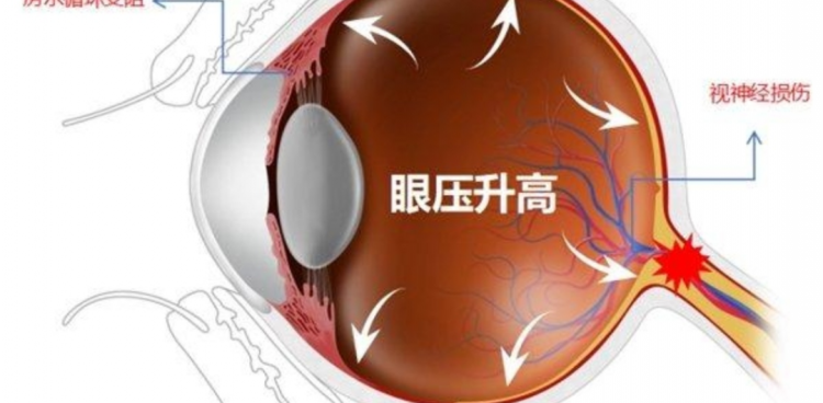 健康科普｜“三高”之外的這一“高”可否知曉？