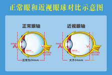 健康科普｜开学季：勿焦虑，理性看待孩子的近视度数增长