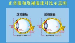 健康科普｜開學(xué)季：勿焦慮，理性看待孩子的近視度數(shù)增長