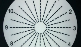 健康科普｜散光是哪里出了問(wèn)題？