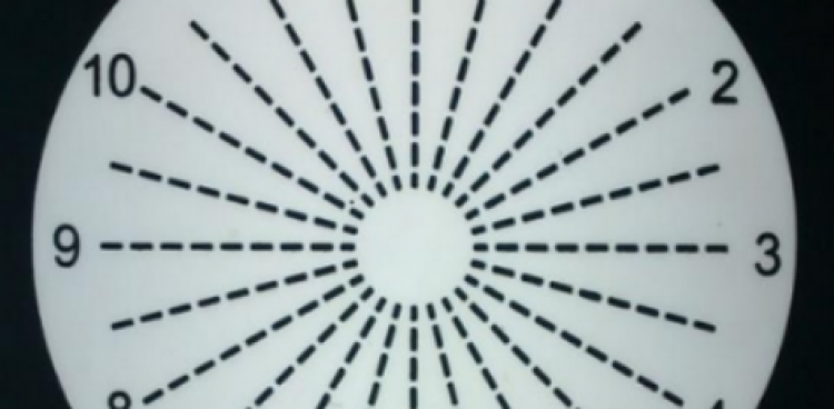 健康科普｜散光是哪里出了问题？