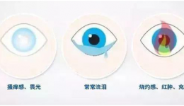 如何選擇人工淚液？藥師教你從“小白”變“專家”