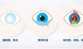 如何選擇人工淚液？藥師教你從“小白”變“專家”