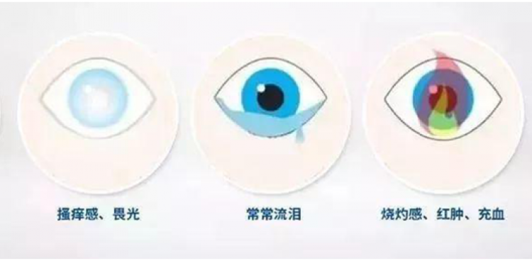 如何選擇人工淚液？藥師教你從“小白”變“專家”