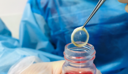 角膜移植的“材料”从哪来？清明，致敬角膜捐献者