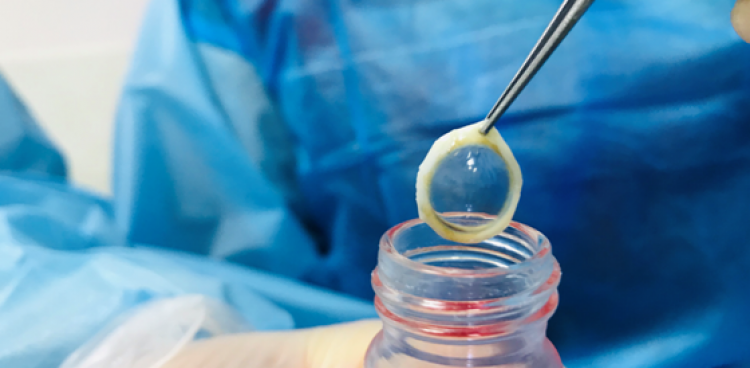 角膜移植的“材料”从哪来？清明，致敬角膜捐献者